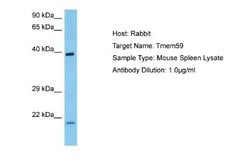 TMEM59 Rabbit anti-Mouse, Polyclonal, Novus Biologicals 0.1ml; Unconjugated:Antibodies,